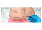 Tummy Tuck Surgery in Mumbai | Harleys Cosmetic Clinic