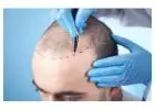Painless Hair Transplant Surgery in Mumbai At Hair And Shape Clinic