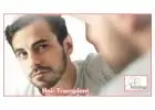 Get Hair Transplant in Gurgaon At SB Trichology