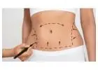 Affordable Tummy Tuck Surgery in Mumbai – Limited Time Offer