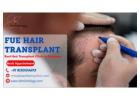 Best Clinic For FUE Hair Transplant in Gurgaon | SB Trichology