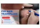 Best Clinic For FUE Hair Transplant in Gurgaon | SB Trichology