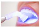 Get a Confident Smile with Teeth Whitening Melbourne Now