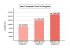 Affordable Hair Transplant Cost in Gurgaon – Book Consultation