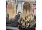 Dallas Top Hair Loss Solutions - Expert Care for Trichotillomania & More