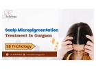 Best Clinic For Scalp Micropigmentation in Gurgaon - SB Trichology