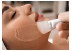 Advanced Chemical Peeling Treatment in Kolkata Glow Now Clinic
