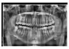 Revive your natural and flawless smiles with holistic Dental care in Tijuana