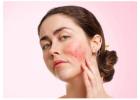 Orlando Dermatologist & Plastic Surgeon | Mid Florida Derm